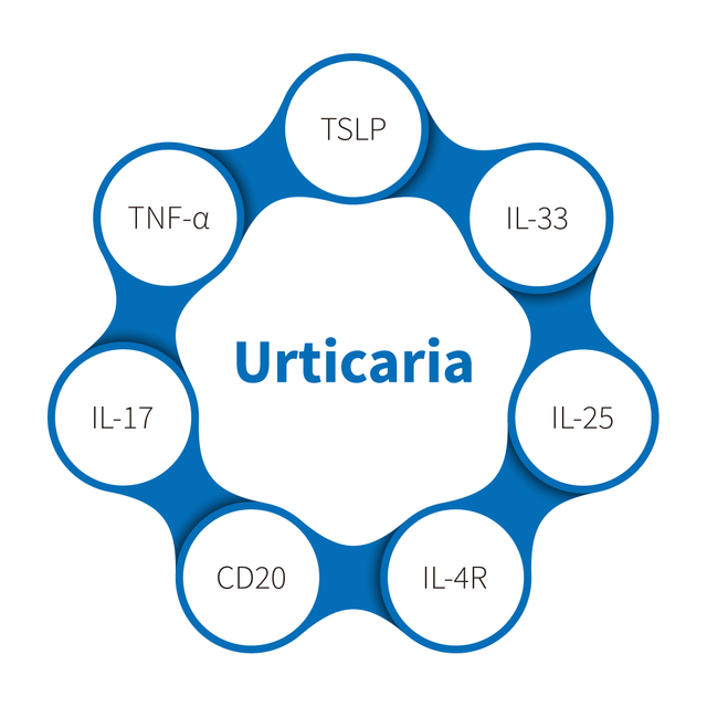 Urticaria
