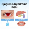 Model NHP Sj&ouml;gren's Syndrome (SjS).