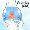 NHP-Kollagen-induzierte Arthritis (CIA)-Modelle