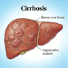 Modelos de cirrosis en ratas
