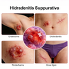 NHP Hidradenitis Suppurativa (HS) mudelid