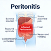 Muse peritonitis model