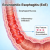 Modelos de esofagitis eosinof&iacute;lica (EoE) en ratones