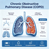 Мэрэгч амьтдын уушигны архаг бөглөрөлт өвчин (COPD) загварууд